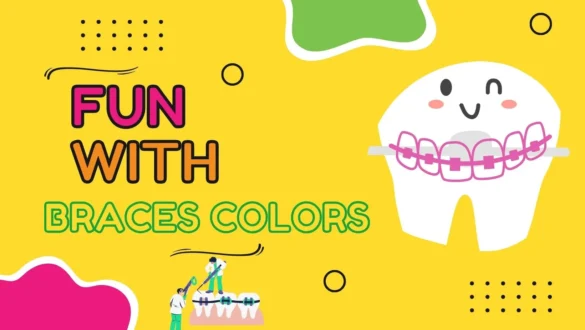 Braces Colors